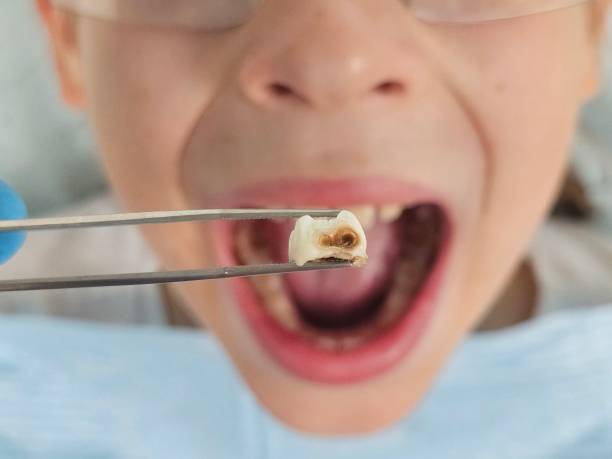 Best Mobile Emergency Dentist in Lyons, KS